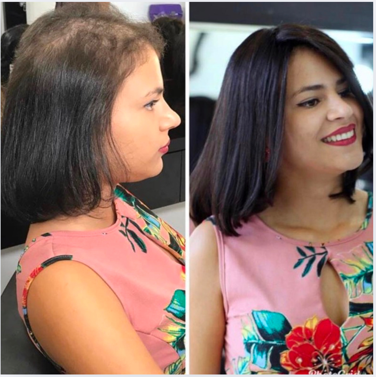 Transformação cliente 5